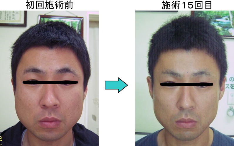 小顔矯正なら徳島整体院へ 徳島整体院は結果にこだわります