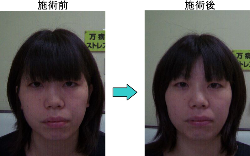 小顔矯正なら徳島整体院へ 徳島整体院は結果にこだわります